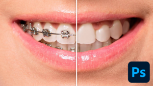Remove Braces in Photoshop Easy Pro-Level Results