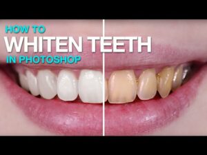 Whiten And Brighten Teeth In Photoshop